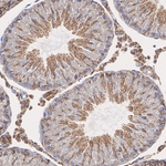 ATP Synthase O Antibody in Immunohistochemistry (Paraffin) (IHC (P))