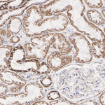 ATP Synthase O Antibody in Immunohistochemistry (Paraffin) (IHC (P))
