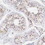 ATP Synthase O Antibody in Immunohistochemistry (Paraffin) (IHC (P))