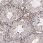 ATP Synthase O Antibody in Immunohistochemistry (Paraffin) (IHC (P))