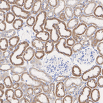 ATP Synthase O Antibody in Immunohistochemistry (Paraffin) (IHC (P))