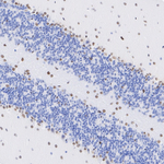 QKI-5 Antibody in Immunohistochemistry (Paraffin) (IHC (P))