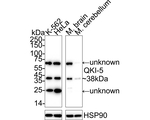 QKI-5 Antibody in Western Blot (WB)