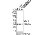 QKI-6 Antibody in Western Blot (WB)