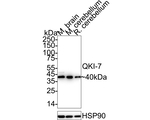 QKI-7 Recombinant Mouse Monoclonal Antibody (PSH10-92)