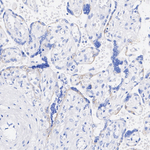 AMOT Antibody in Immunohistochemistry (Paraffin) (IHC (P))