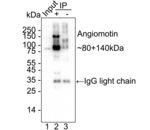 AMOT Antibody in Immunoprecipitation (IP)