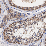 LIMK1 Antibody in Immunohistochemistry (Paraffin) (IHC (P))