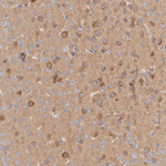 LIMK1 Recombinant Rabbit Monoclonal Antibody (PSH08-68)