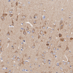 LIMK1 Antibody in Immunohistochemistry (Paraffin) (IHC (P))