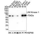LIMK1 Antibody in Western Blot (WB)