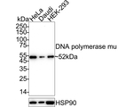 POLM Recombinant Rabbit Monoclonal Antibody (PSH08-75)