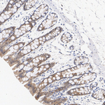 LIMK2 Antibody in Immunohistochemistry (Paraffin) (IHC (P))