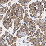 LIMK2 Antibody in Immunohistochemistry (Paraffin) (IHC (P))