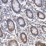 LIMK2 Antibody in Immunohistochemistry (Paraffin) (IHC (P))