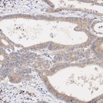 LIMK2 Antibody in Immunohistochemistry (Paraffin) (IHC (P))