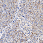LIMK2 Antibody in Immunohistochemistry (Paraffin) (IHC (P))