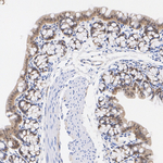 LIMK2 Antibody in Immunohistochemistry (Paraffin) (IHC (P))