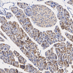 LIMK2 Antibody in Immunohistochemistry (Paraffin) (IHC (P))