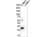 LIMK2 Antibody in Western Blot (WB)