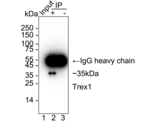 TREX1 Antibody in Immunoprecipitation (IP)