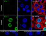 Epstein Barr Virus BOLF1 Antibody in Immunocytochemistry (ICC/IF)