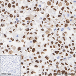 Epstein Barr Virus BOLF1 Antibody in Immunohistochemistry (Paraffin) (IHC (P))