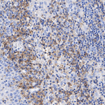CD27 Antibody in Immunohistochemistry (Paraffin) (IHC (P))