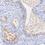 MMP7 Antibody in Immunohistochemistry (Paraffin) (IHC (P))