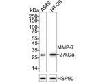 MMP7 Antibody in Western Blot (WB)
