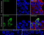 CD8b Recombinant Rabbit Monoclonal Antibody (PSH08-98)