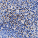 CD8b Antibody in Immunohistochemistry (Paraffin) (IHC (P))
