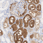PSAT1 Antibody in Immunohistochemistry (Paraffin) (IHC (P))