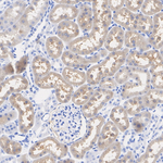 PSAT1 Antibody in Immunohistochemistry (Paraffin) (IHC (P))
