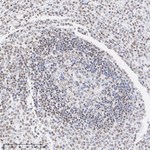 Ubiquitin (linkage specific K27) Antibody in Immunohistochemistry (Paraffin) (IHC (P))