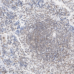 Ubiquitin (linkage specific K27) Antibody in Immunohistochemistry (Paraffin) (IHC (P))