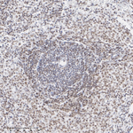 Ubiquitin (linkage specific K27) Antibody in Immunohistochemistry (Paraffin) (IHC (P))