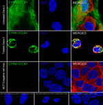 CYR61 Recombinant Rabbit Monoclonal Antibody (PSH09-12)