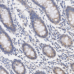 CYR61 Antibody in Immunohistochemistry (Paraffin) (IHC (P))