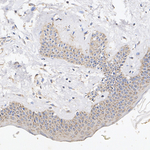 CYR61 Antibody in Immunohistochemistry (Paraffin) (IHC (P))