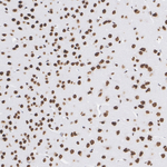 TDP-43 Antibody in Immunohistochemistry (Paraffin) (IHC (P))