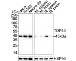 TDP-43 Antibody in Western Blot (WB)