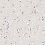 SLC11A2 Recombinant Rabbit Monoclonal Antibody (PSH09-20)