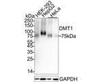 SLC11A2 Antibody in Western Blot (WB)