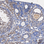 TGF beta-3 Antibody in Immunohistochemistry (Paraffin) (IHC (P))