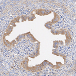 TGF beta-3 Antibody in Immunohistochemistry (Paraffin) (IHC (P))