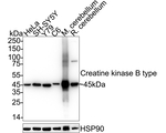 Creatine Kinase BB Antibody in Western Blot (WB)