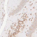 SEC61B Antibody in Immunohistochemistry (Paraffin) (IHC (P))