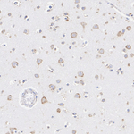 SEC61B Antibody in Immunohistochemistry (Paraffin) (IHC (P))