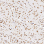 SEC61B Antibody in Immunohistochemistry (Paraffin) (IHC (P))